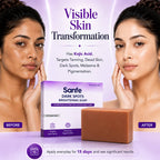 Sanfe Kojic Acid Soap for Dark Spots & Pigmentation